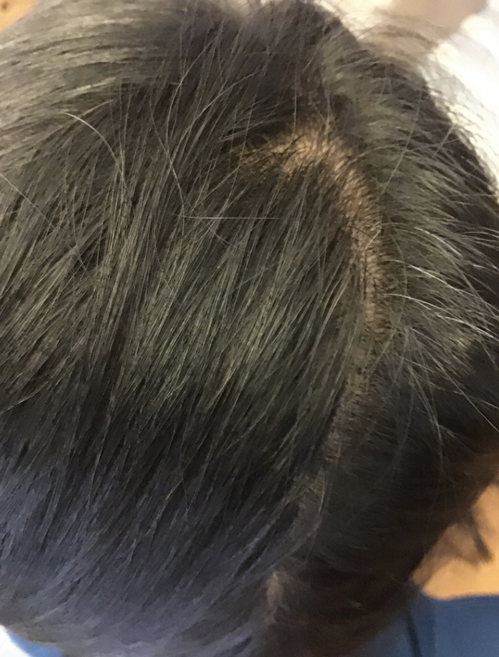 リライズが染まらない 実際に使ってみた感想と注意したい点 ゆらぎビューティ